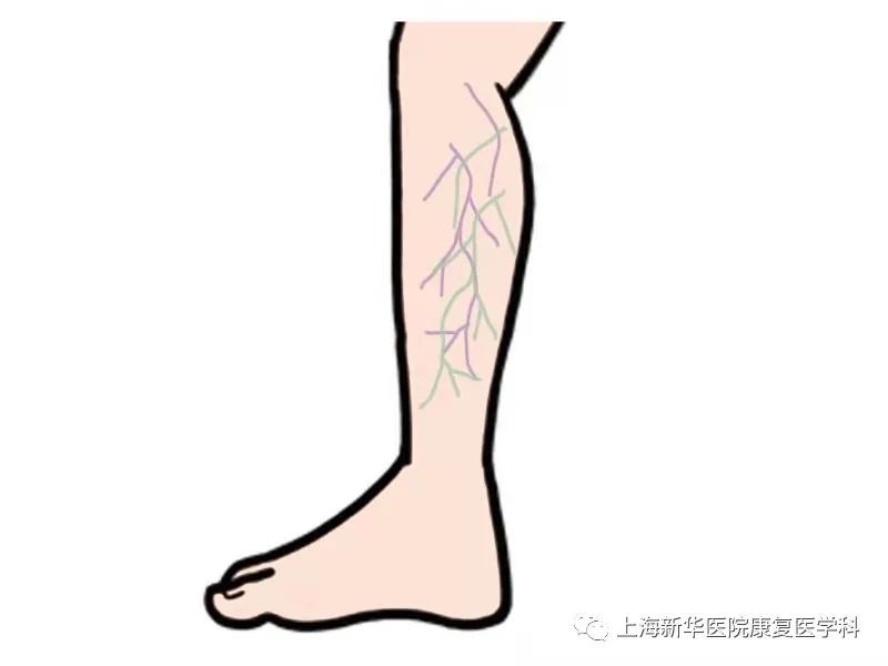 Your legs are always swollen for no reason, you may be suffe