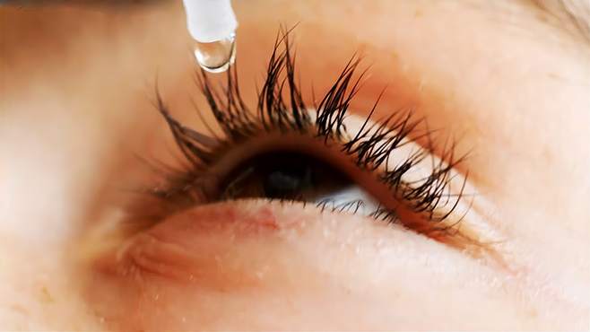 Naughty child drops glue in his eye - This is how a clever d