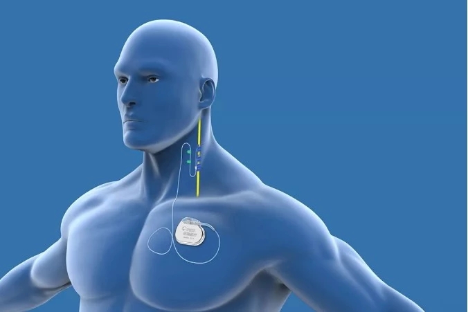 Brain Pacemaker: A Metronome for the Brain to Keep the Nerves in Step with Life