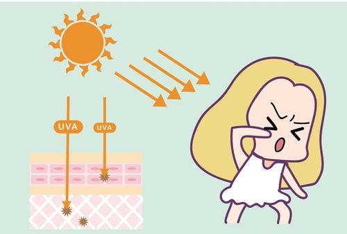 Getting sunburnt without sunscreen What should you do if you apply sunscreen and get pimples?